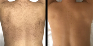 2-300x150